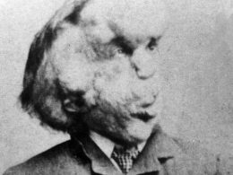 elephant-man-joseph-merrick