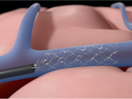 synchron series khosla venturesparkfiercebiotech